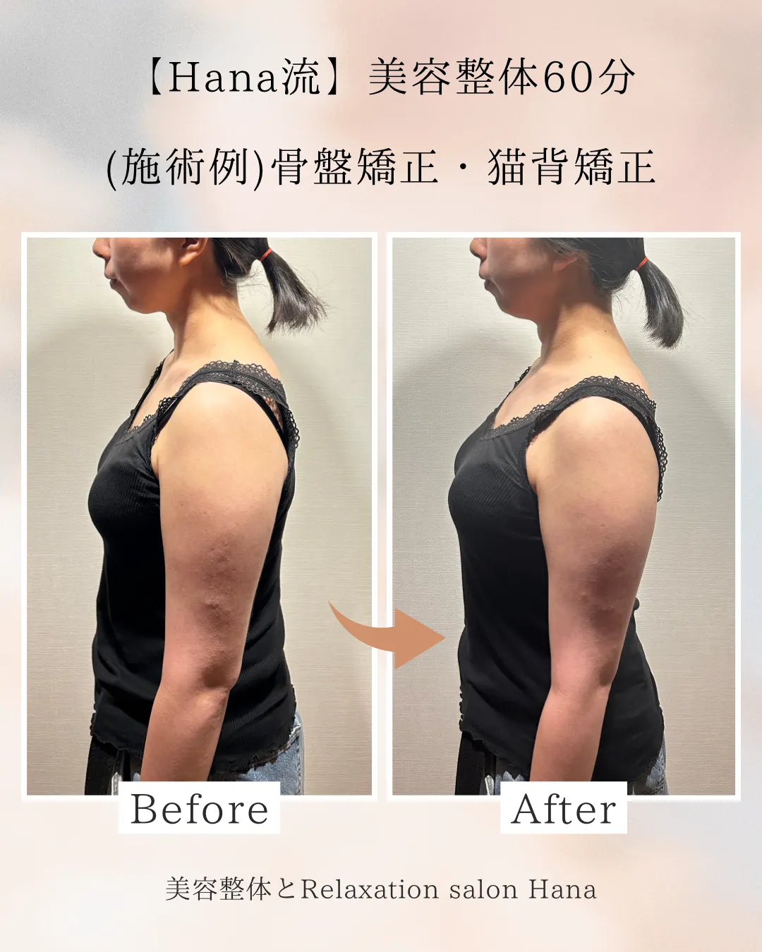 【文京区で姿勢改善をお探しの方へ】