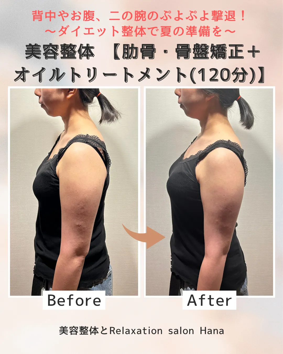 【夏服を綺麗に着こなす準備はできていますか?背中やお腹、二の腕のぷよぷよを撃退したい駒込・本駒込にお住まい方へ】